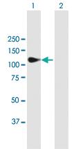 Anti-MATN2 Mouse Polyclonal Antibody