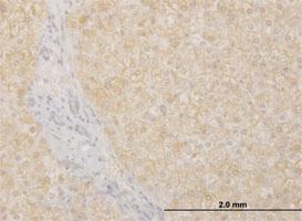 Anti-POMGNT1 Mouse Monoclonal Antibody [clone: 6C12]