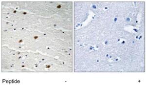 Anti-AKT1 Rabbit Polyclonal Antibody