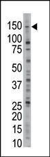 Anti-USP28 Rabbit Polyclonal Antibody (HRP (Horseradish Peroxidase))