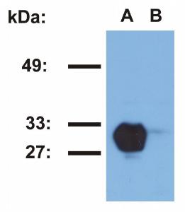 Anti-HLA DR Mouse Monoclonal Antibody [Clone: MEM-267]