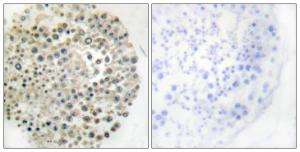 Antibody anti-TRIM16 100 µg