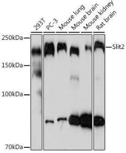 Western blot analysis of extracts of various cell lines, using Anti-Slit2 Antibody [ARC2010] (A306027) at 1:1000 dilution