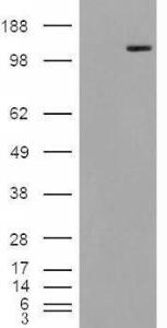 HEK293 overexpressing Man2A1 (RC220186) and probed with Anti-MAN2A1 Antibody (A84446) (mock transfection in first lane), tested by Origene