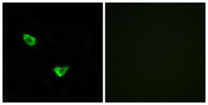 Immunofluorescence analysis of MCF7 cells using Anti-CHSY2 Antibody. The right hand panel represents a negative control, where the antibody was pre-incubated with the immunising peptide