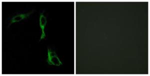 Immunofluorescence analysis of HeLa cells using Anti-ADRA1D Antibody. The right hand panel represents a negative control, where the Antibody was pre-incubated with the immunising peptide