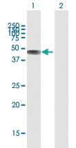 Anti-C2CD2 Rabbit Polyclonal Antibody