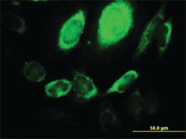 Anti-ARHGEF1 Mouse Monoclonal Antibody [clone: 4C4]