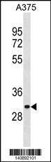 Anti-ARMCX6 Rabbit Polyclonal Antibody (APC (Allophycocyanin))