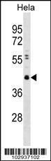 Anti-CBX8 Rabbit Polyclonal Antibody (AP (Alkaline Phosphatase))