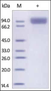 The purity of rh CD10 / MME was determined by DTT-reduced (+) SDS-PAGE and staining overnight with Coomassie Blue.