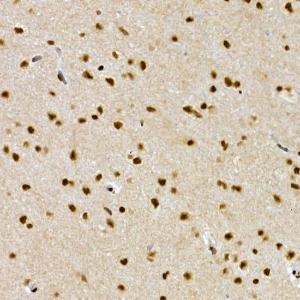 Immunohistochemistry analysis of paraffin-embedded rat brain using Anti-SCAF4 Antibody (A308954) at a dilution of 1:50 (40X lens). Perform high pressure antigen retrieval with 10 mM citrate buffer pH 6.0 before commencing with IHC staining protocol