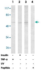 Anti-AKT2 Rabbit Polyclonal Antibody