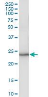 Anti-ARL11 Polyclonal Antibody Pair