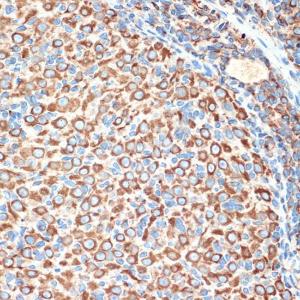 Immunohistochemistry analysis of paraffin-embedded rat ovary using Anti-Slit2 Antibody [ARC2010] (A306027) at a dilution of 1:100 (40x lens). Perform microwave antigen retrieval with 10 mM Tris/EDTA buffer pH 9.0 before commencing with IHC staining protocol