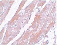 Anti-CCDC47 Rabbit Polyclonal Antibody