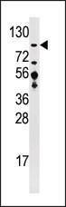 Anti-USP33 Rabbit Polyclonal Antibody (APC (Allophycocyanin))