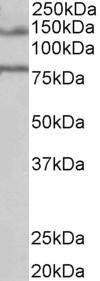 Anti-EPB41L5 Antibody (A84448) (1 µg/ml) staining of Human Brain (Hippocampus) lysate (35 µg protein in RIPA buffer). Primary incubation was 1 hour. Detected by chemiluminescence