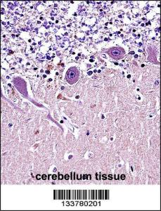 Anti-CRMP1 Rabbit Polyclonal Antibody (Biotin)