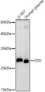 Western blot analysis of extracts of various cell lines, using Anti-Factor D/CFD Antibody [ARC2997] (A310008) at 1:1,000 dilution The secondary antibody was Goat Anti-Rabbit IgG H&L Antibody (HRP) at 1:10,000 dilution Lysates/proteins were present at 25 µg per lane