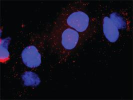 Anti-CDK7 + E2F1 Antibody Pair