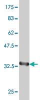 Anti-PAX8 Mouse Monoclonal Antibody [clone: 3G11]