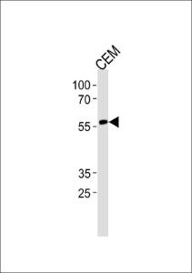 Anti-RUNX2 Rabbit Polyclonal Antibody (PE (Phycoerythrin))