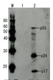 Anti-HIV1 p55 + p24 + p17 Antibody