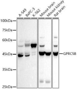 Anti-GPCR GPRC5B Rabbit Monoclonal Antibody [clone: ARC2932]