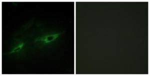 Immunofluorescence analysis of NIH/3T3 cells using Anti-CDH22 Antibody. The right hand panel represents a negative control, where the antibody was pre-incubated with the immunising peptide.