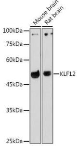 Western blot analysis of extracts of various cell lines, using Anti-KLF12 Antibody (A306028) at 1:1,000 dilution The secondary antibody was Goat Anti-Rabbit IgG H&L Antibody (HRP) at 1:10,000 dilution Lysates/proteins were present at 25 µg per lane