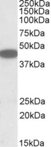 EB09999 (1 µg/ml) staining of HEK293 lysate (35 µg protein in RIPA buffer). Primary incubation was 1 hour. Detected by chemiluminescence.