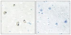 Immunohistochemical analysis of paraffin-embedded human brain tissue using Anti-CDH22 Antibody. The right hand panel represents a negative control, where the antibody was pre-incubated with the immunising peptide.