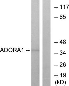 Western blot analysis of lysates from MCF-7 cells using Anti-ADORA1 Antibody. The right hand lane represents a negative control, where the antibody is blocked by the immunising peptide.