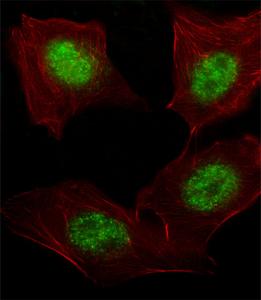 Anti-ARNT Rabbit Polyclonal Antibody