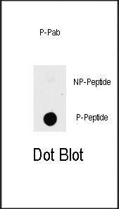 Anti-PAK1 Rabbit Polyclonal Antibody (PE (Phycoerythrin))