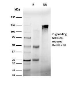 SDS-PAGE analysis of Anti-FRA2 Antibody [PCRP-FOSL2-1B1] under non-reduced and reduced conditions; showing intact IgG and intact heavy and light chains, respectively. SDS-PAGE analysis confirms the integrity and purity of the Antibody