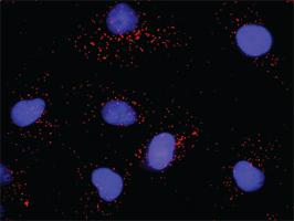 Anti-PTK2 + PLCG1 Antibody Pair