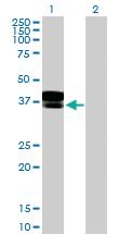 Anti-DCN Rabbit Polyclonal Antibody