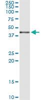 Anti-MAPK13 Mouse Monoclonal Antibody [clone: 2B6]