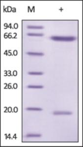 The purity of rh PCSK9 (D374Y) was determined by DTT-reduced (+) SDS-PAGE and staining overnight with Coomassie Blue.