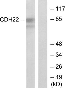 Western blot analysis of lysates from rat brain cells using Anti-CDH22 Antibody. The right hand lane represents a negative control, where the antibody is blocked by the immunising peptide.