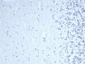 Negative Tissue Control: Immunohistochemical analysis of formalin-fixed, paraffin-embedded human brain using Anti-GATA3 Antibody [GATA3/4550R] at 2 µg/ml in PBS for 30 minutes at room temperature