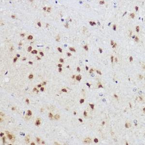 Immunohistochemistry analysis of paraffin-embedded mouse brain using Anti-KLF12 Antibody (A306028) at a dilution of 1:100 (40x lens) Perform high pressure antigen retrieval with 10 mM citrate buffer pH 60 before commencing with IHC staining protocol