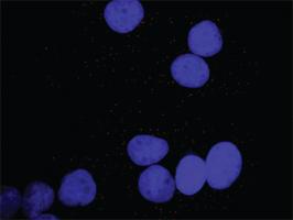 Anti-PDGFA + PLCG1 Antibody Pair