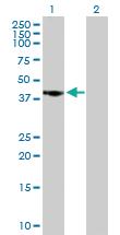 Anti-CAMK1D Mouse Polyclonal Antibody