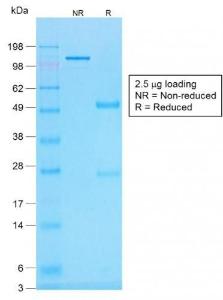 SDS-PAGE analysis of Anti-Histone H1 Antibody [r1415-1] under non-reduced and reduced conditions; showing intact IgG and intact heavy and light chains, respectively. SDS-PAGE analysis confirms the integrity and purity of the antibody.