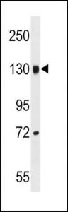 Anti-LEPR Rabbit Polyclonal Antibody (HRP (Horseradish Peroxidase))