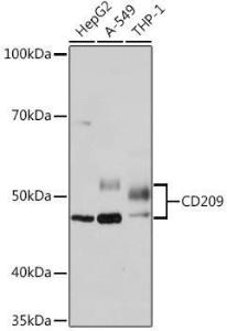 Anti-DC-SIGN Rabbit Monoclonal Antibody [clone: ARC1679]