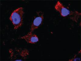 Anti-CCNB1 + CDKN1A Antibody Pair